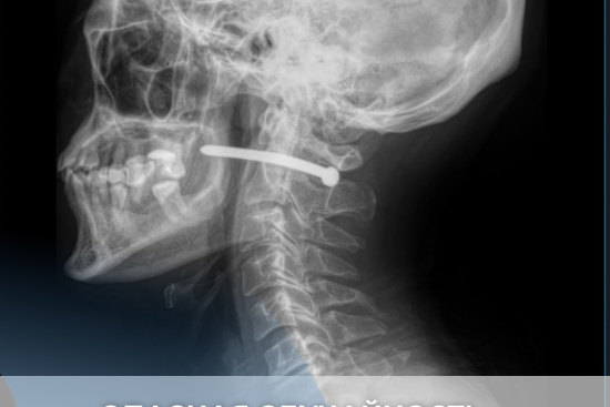 Опасная случайность — с благополучным исходом